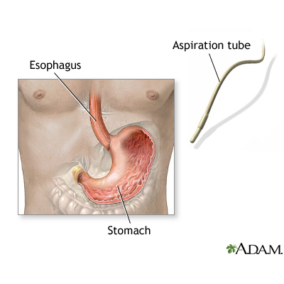 The Importance of Stomach Acid