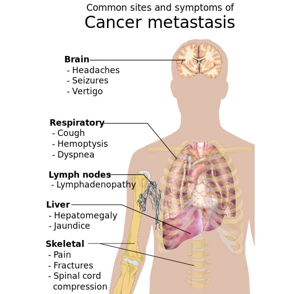 Destroying Cancer Cells